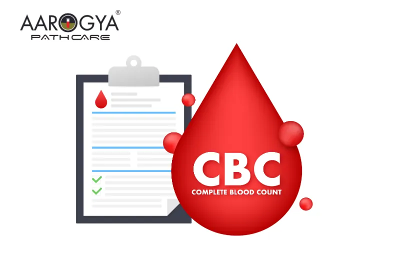 Complete Blood Test (CBC) In Delhi