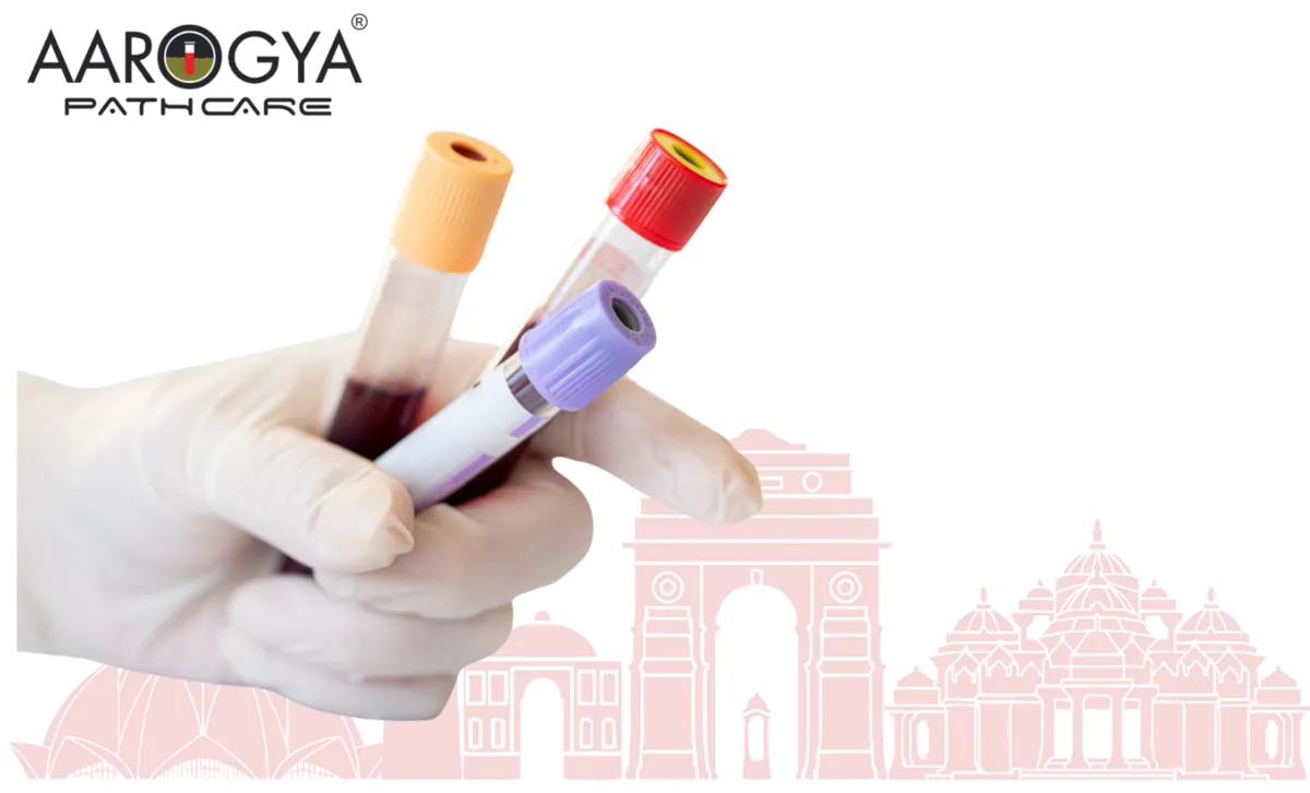 Blood Test In Delhi NCR | Book Your Appointment With Aarogya Pathcare