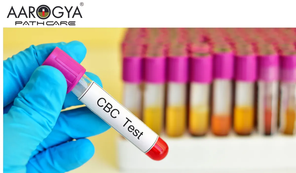 Aarogya Pathcare Comprehensive CBC Testing Made Easy