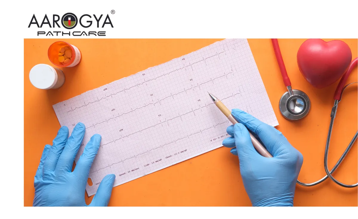 Empowering Heart Wellness: Aarogya Pathcare ECG Excellence