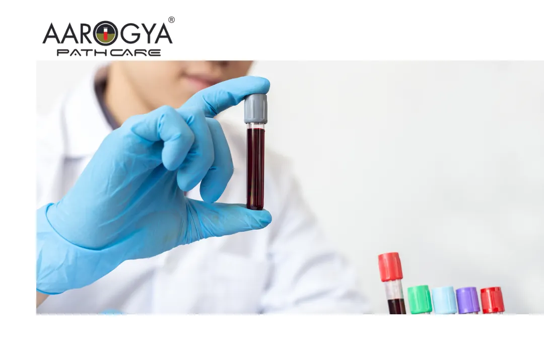 Complete Guide on Blood Test in Delhi-NCR