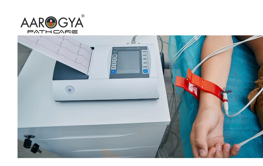 Get the Best ECG in Delhi-NCR at Aarogya Pathcare