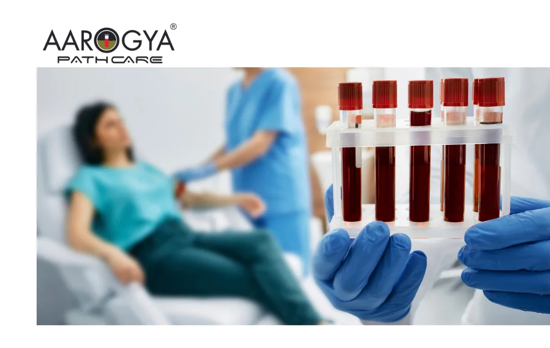 Get Your Blood Test in Delhi-NCR at Ease | Aarogya Pathcare
