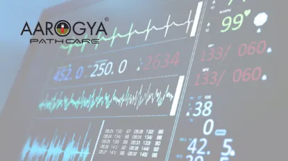 Best ECG Test Services in Delhi NCR