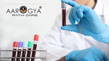 Schedule Your Blood Test with Aarogya Pathcare for Accurate Results