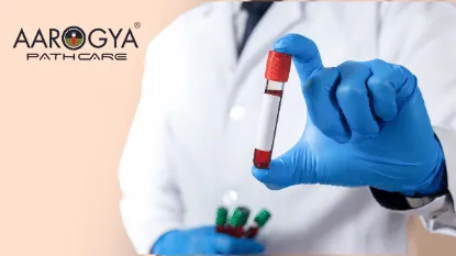 Book Blood Test @199 in Delhi NCR | Blood Test Near Me Aarogya Pathcare